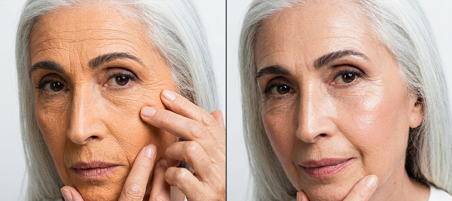 A split-screen comparison of an older woman's face, with more wrinkled skin on the left and smoother skin on the right.