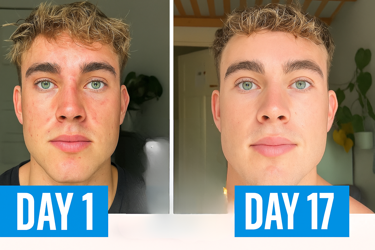 Side-by-side comparison of a person's face on Day 1 and Day 17.