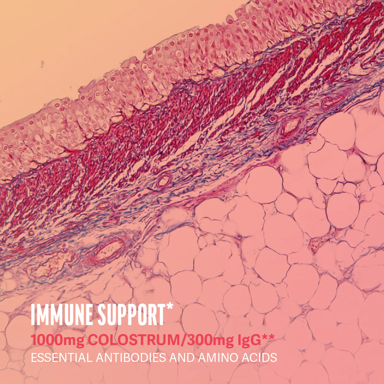 Microscopic view of tissue with text about immune support and colostrum.