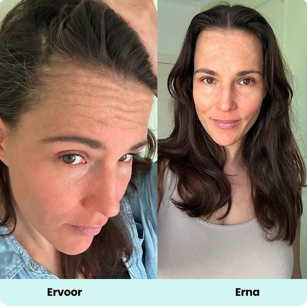 Two side-by-side photos of a woman with different hairstyles.