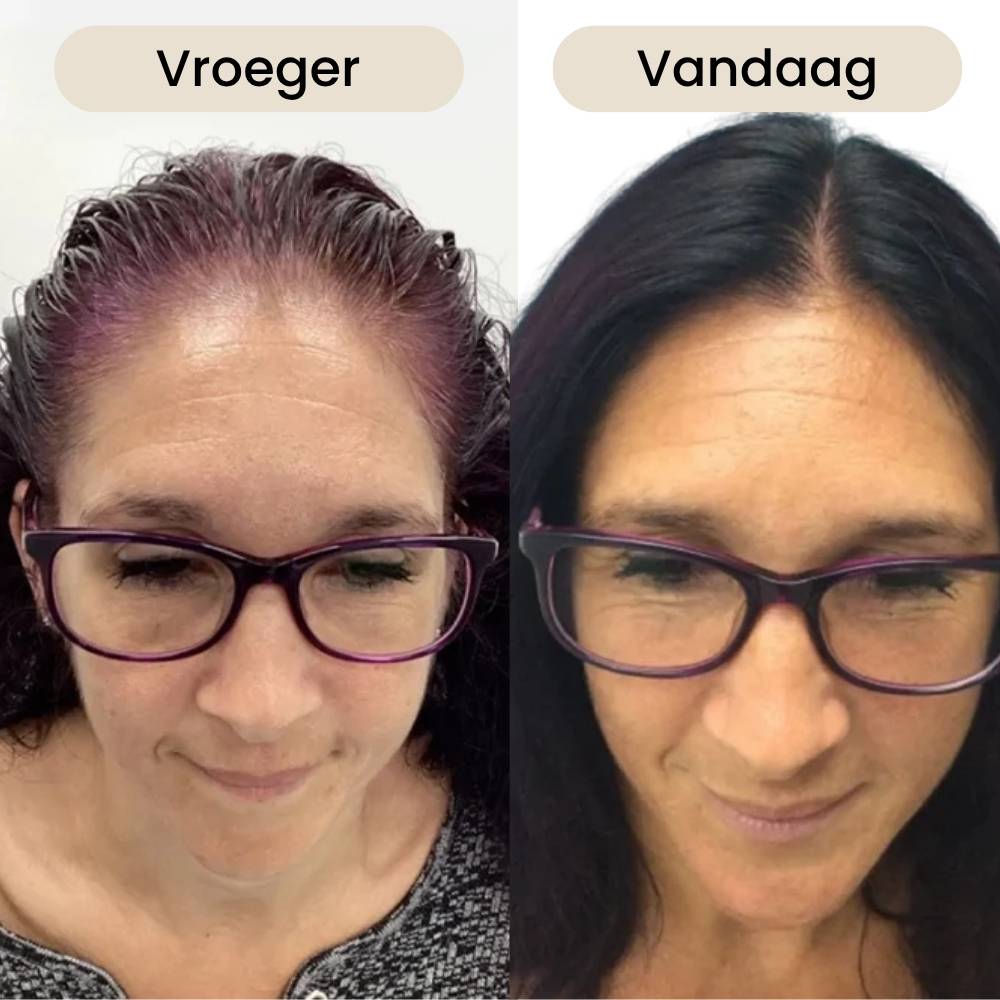 Two side-by-side photos of a woman with different hair colors labeled 'Auparavant' and 'Aujourd'hui'.