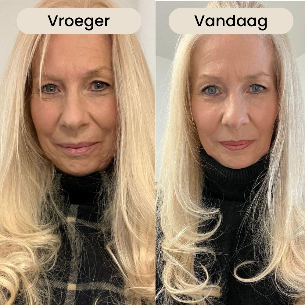 Two side-by-side photos of a woman with blonde hair labeled 'Vroeger' and 'Vandaag'.