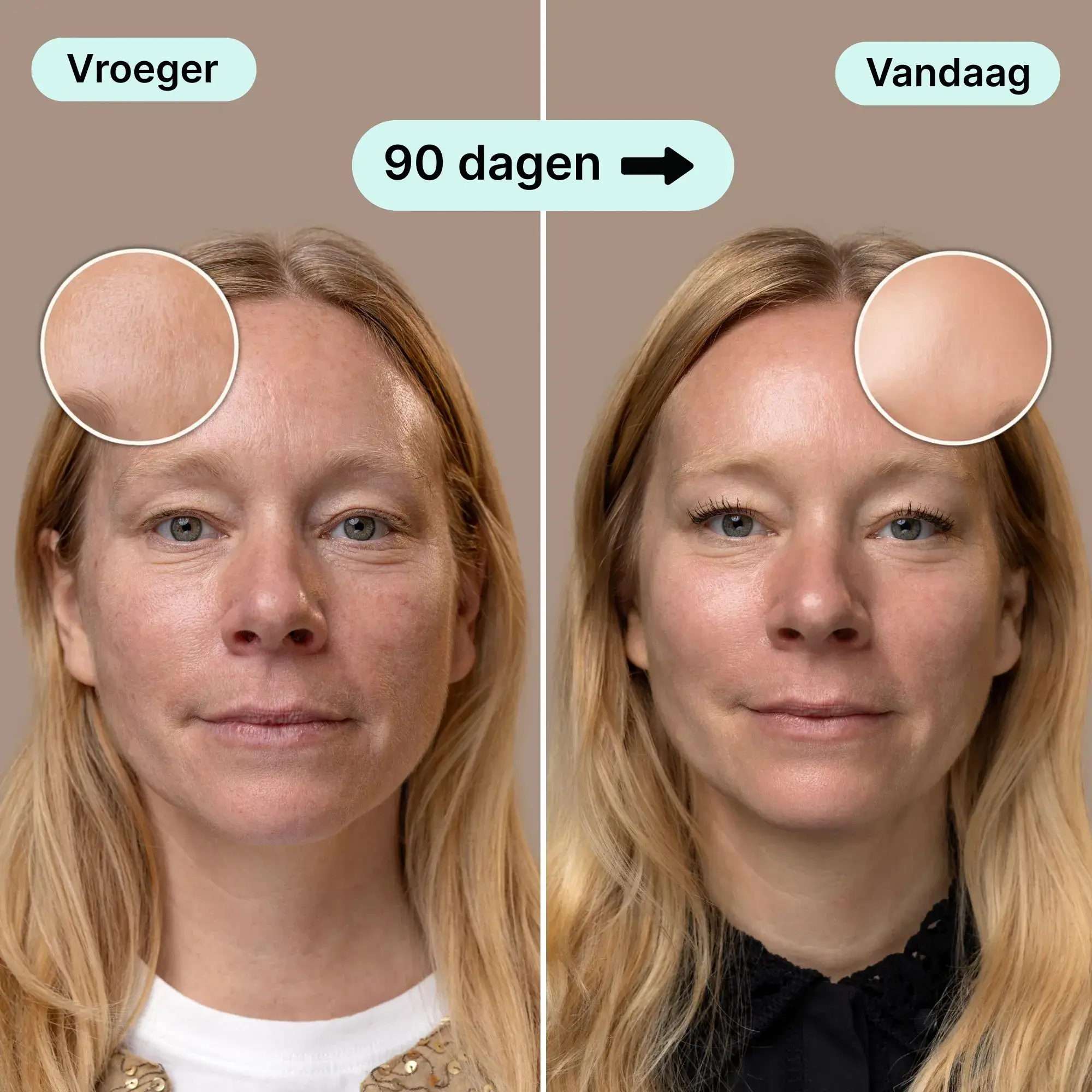 Side-by-side comparison of a woman's face before and after 90 days.