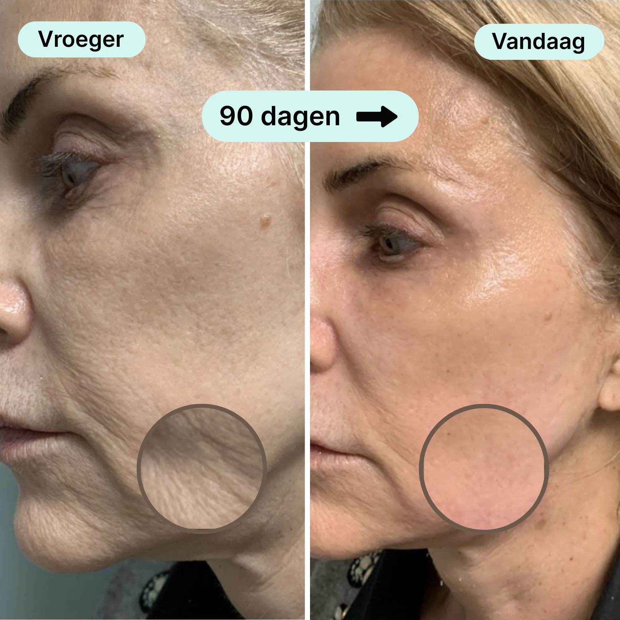 Side-by-side comparison of a woman's face before and after 90 days.