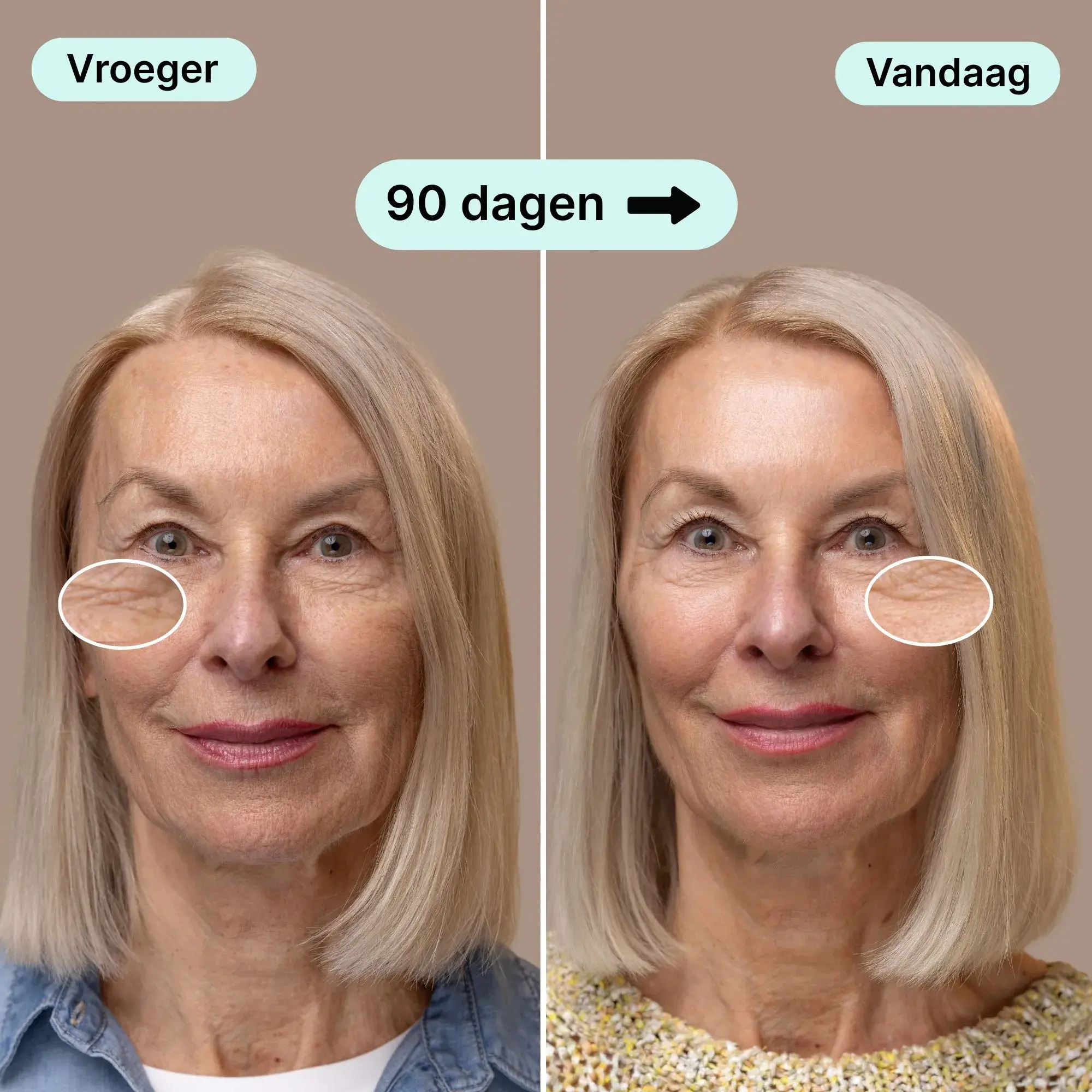Side-by-side comparison of a woman's face before and after 90 days.