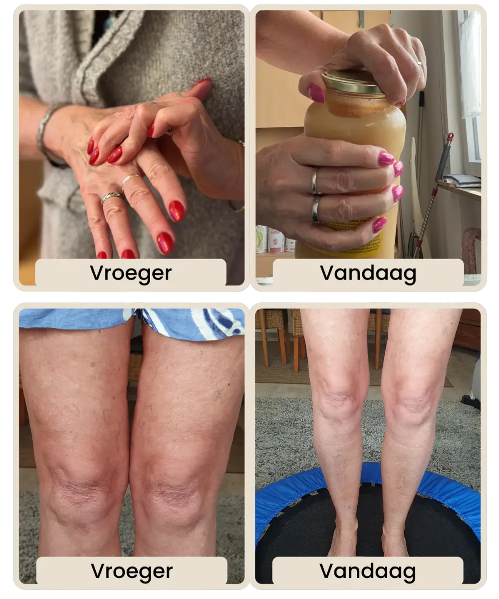 Comparison of hands and knees marked 'Vroeger' and 'Vandaag'.