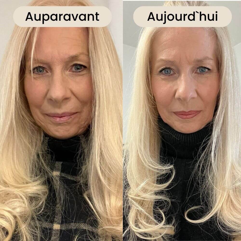 Side-by-side comparison of a woman with long blonde hair labeled 'Auparavant' and 'Aujourd'hui.'