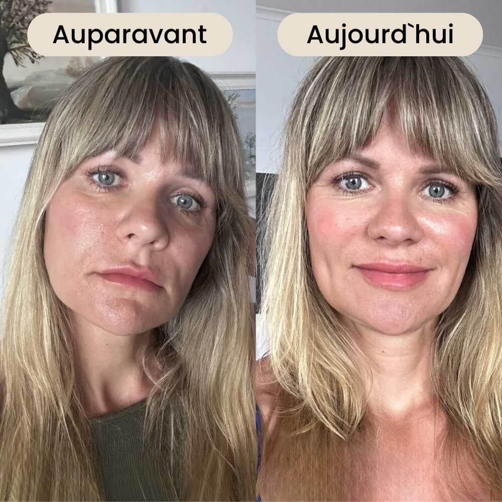 Comparison of two photos of a woman labeled 'Auparavant' and 'Aujourd'hui'.