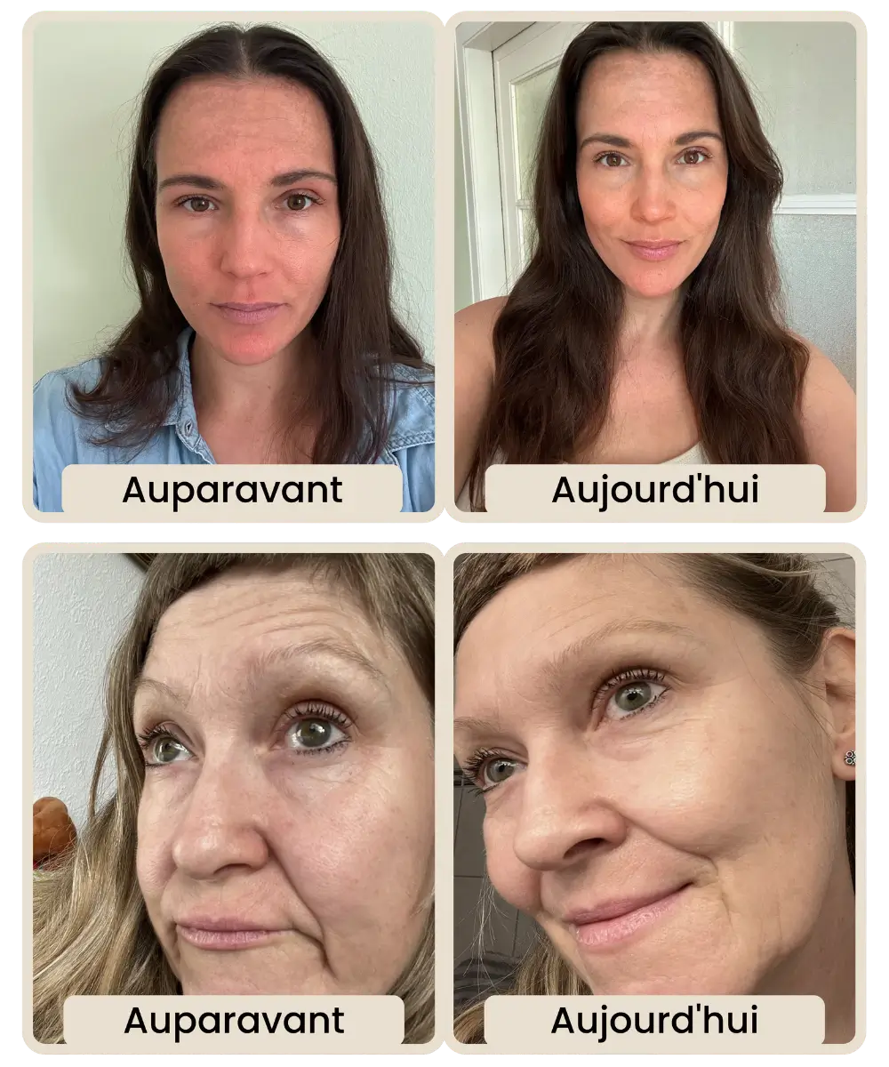 Comparison of women's faces labeled 'Before' and 'After' in French.