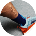 A close-up of a person's ankle with varicose veins, wearing a blue sock and a running shoe.