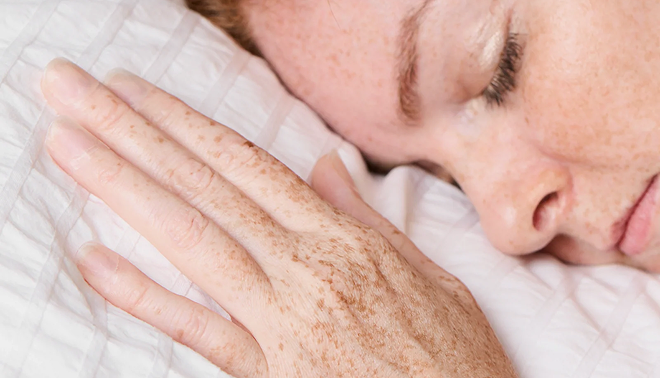 A close-up of a person with freckles sleeping, their hand resting by their face on a white pillow.