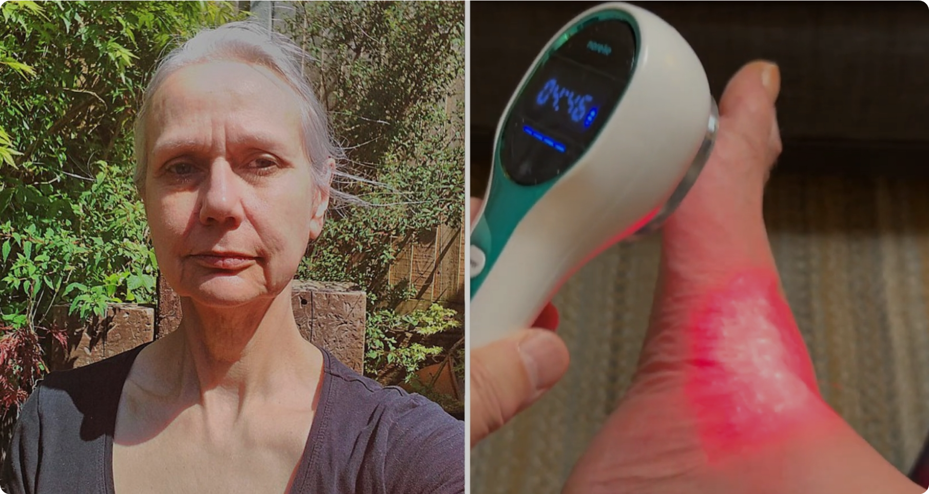 Split image: woman outdoors, device emitting red light on foot.