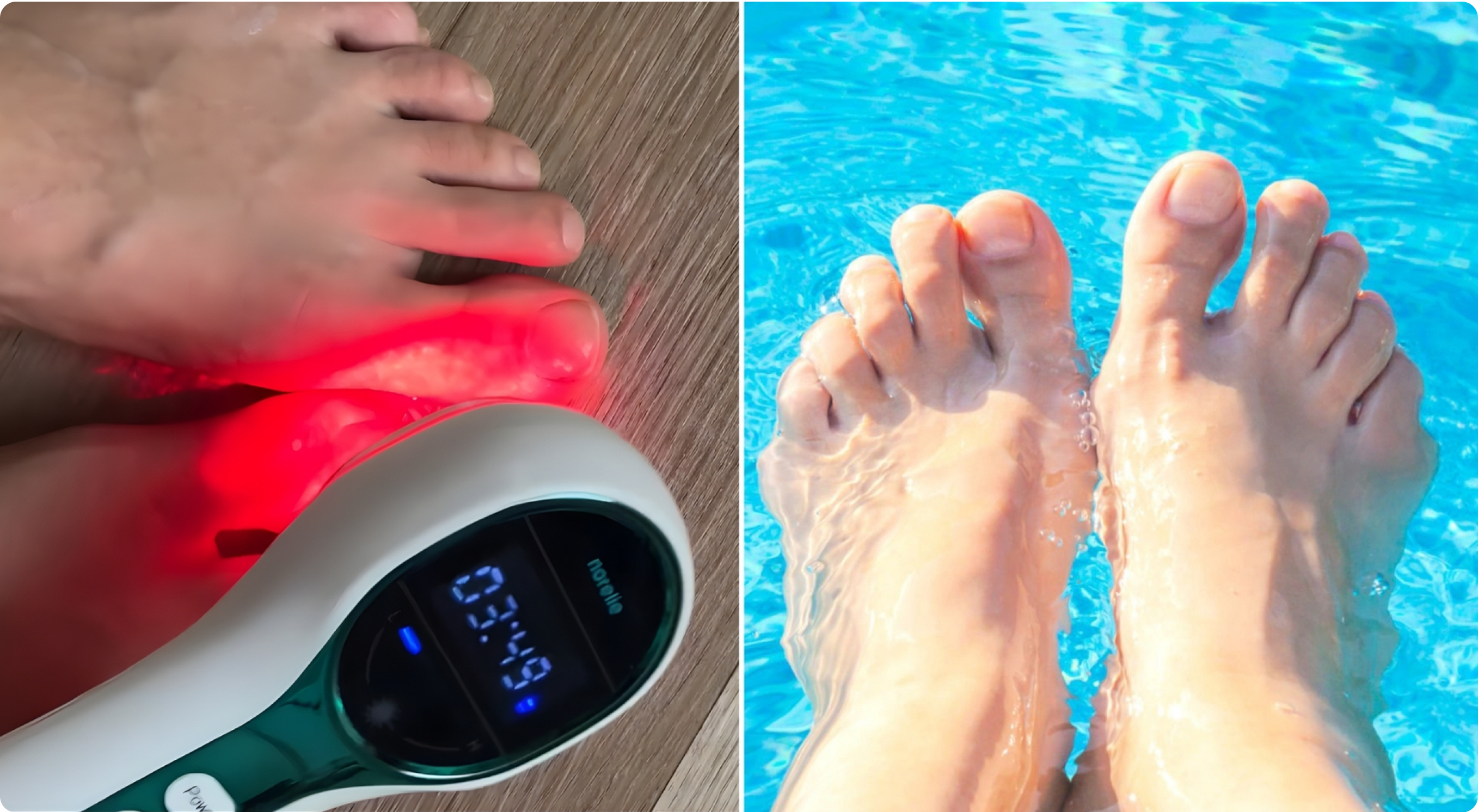 Two images: feet with a red light device, feet in a swimming pool.