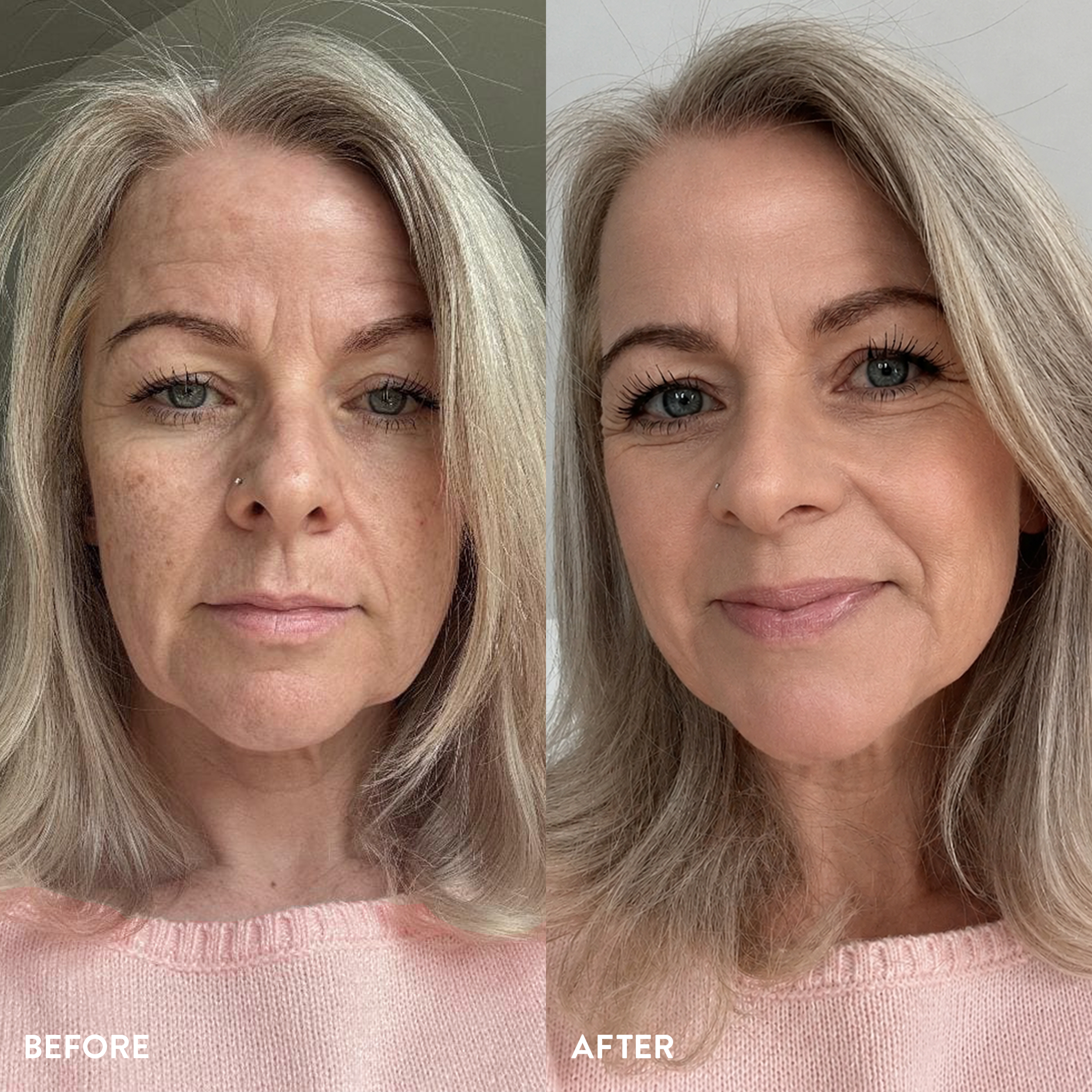 A side-by-side comparison shows a woman's face before and after applying makeup to even her skin tone.