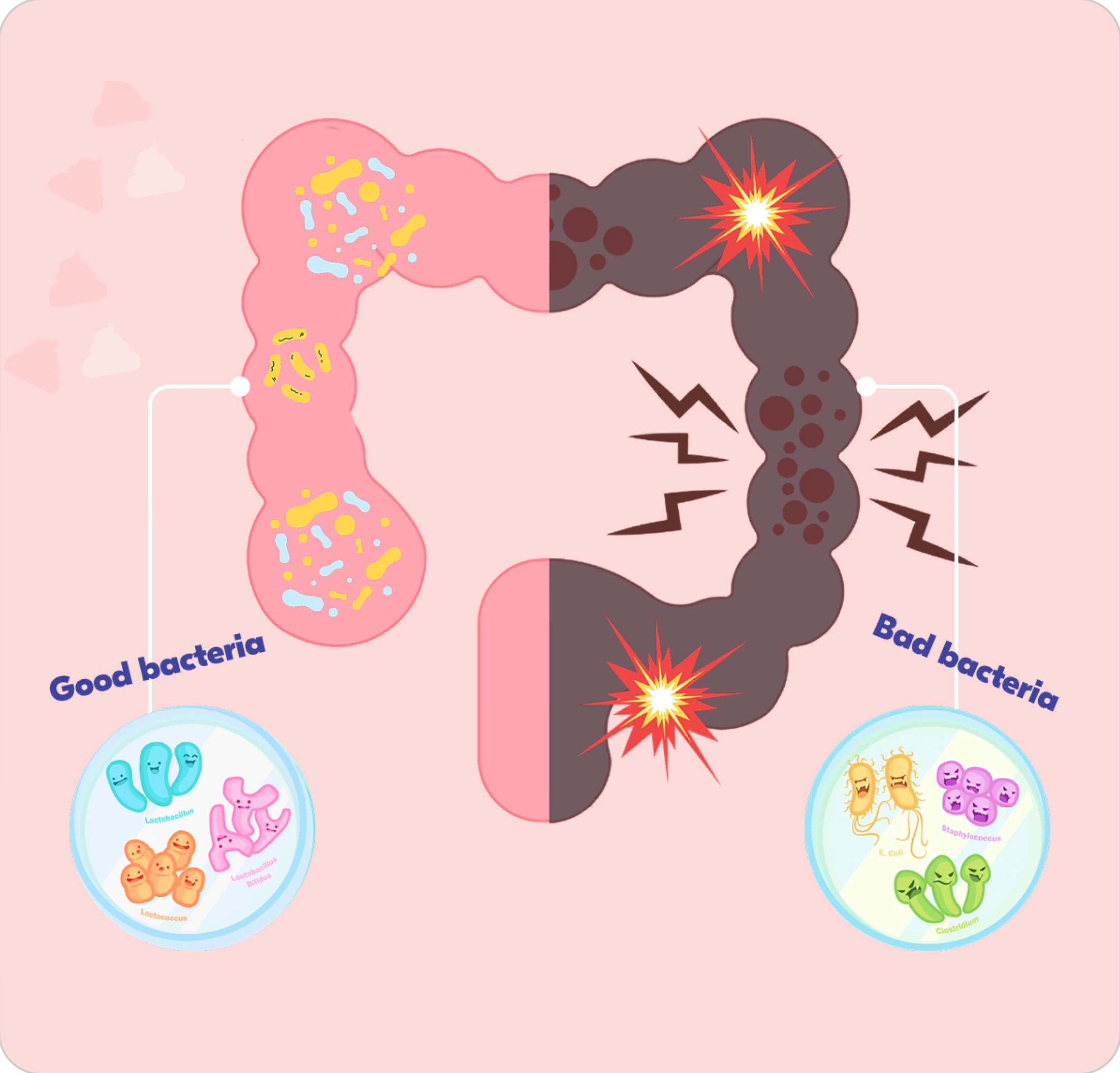 Illustration of intestines showing good and bad bacteria with labeled diagrams.