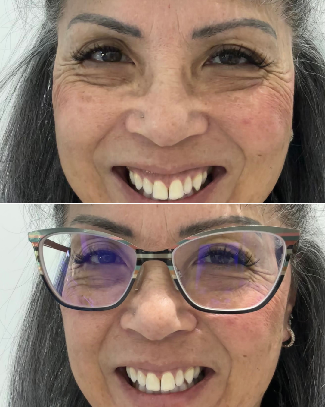 Two close-up images of a smiling woman, one with glasses and one without.