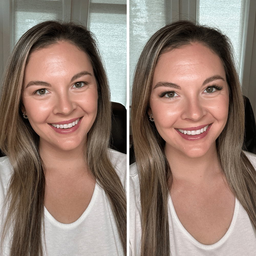 Side-by-side comparison of a woman smiling in two similar photos.