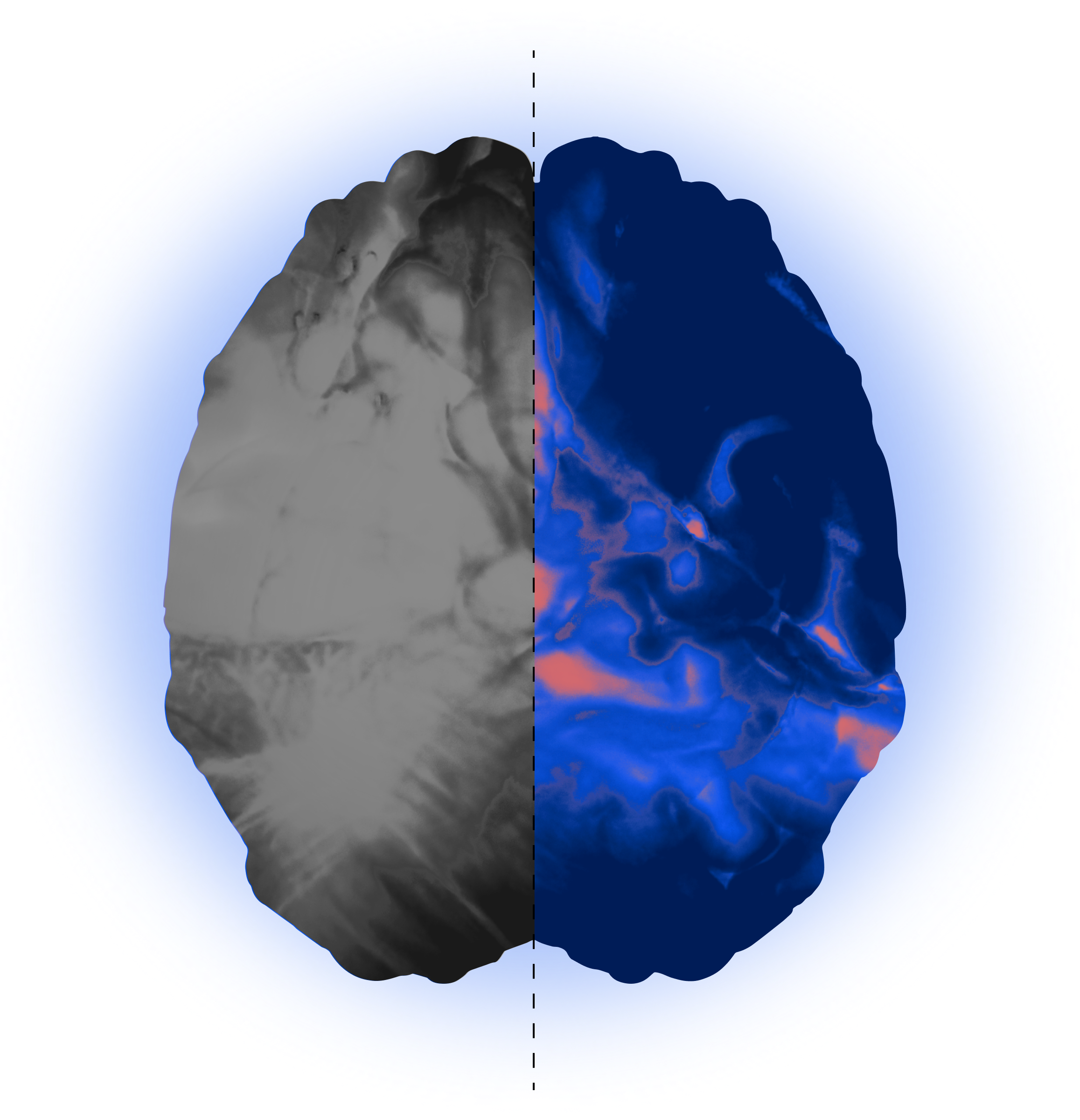 Split image of a brain, left side grayscale, right side blue and red.