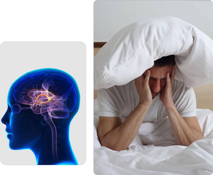 Illustration of a brain and a man in bed with a pillow over his head.