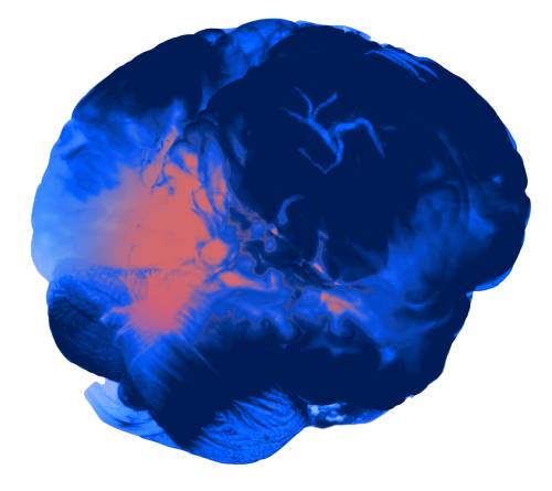 Abstract image of a brain with blue and orange colors.