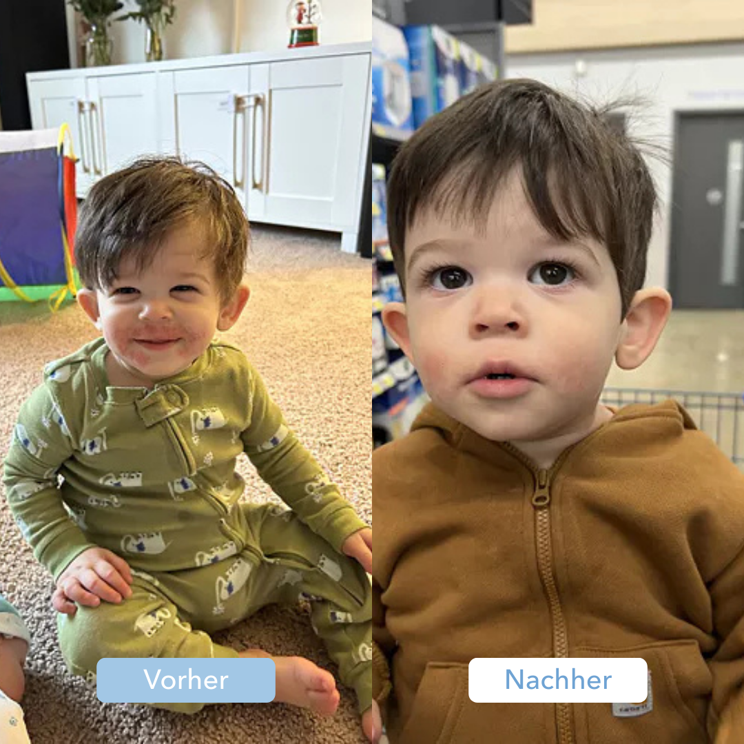 Two images of a young child, one in green pajamas, the other in a brown hoodie.