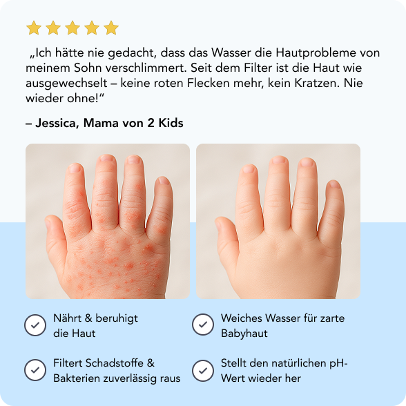 Two images of a child's hand, one with skin irritation, one without.
