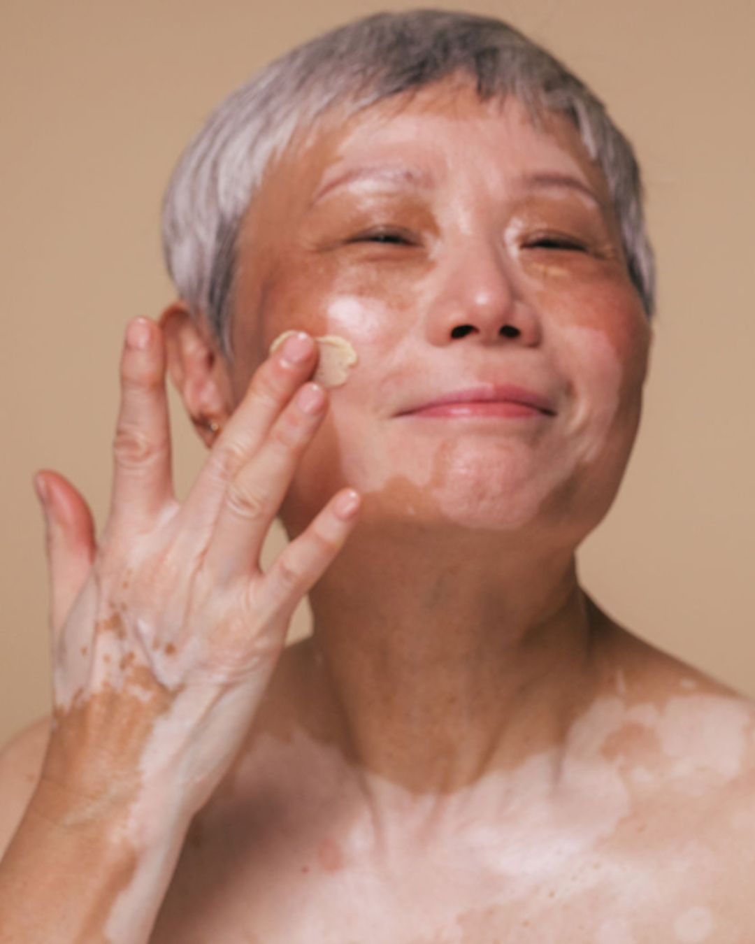An older woman with vitiligo smiles with her eyes closed while applying cream to her cheek.