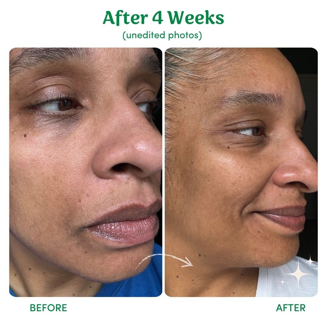 Side-by-side comparison of a woman's face, labeled as 'Before' and 'After 4 Weeks'.