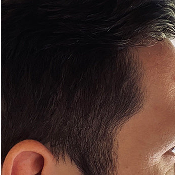 Close-up of a person's ear and side of the head with short, dark hair.