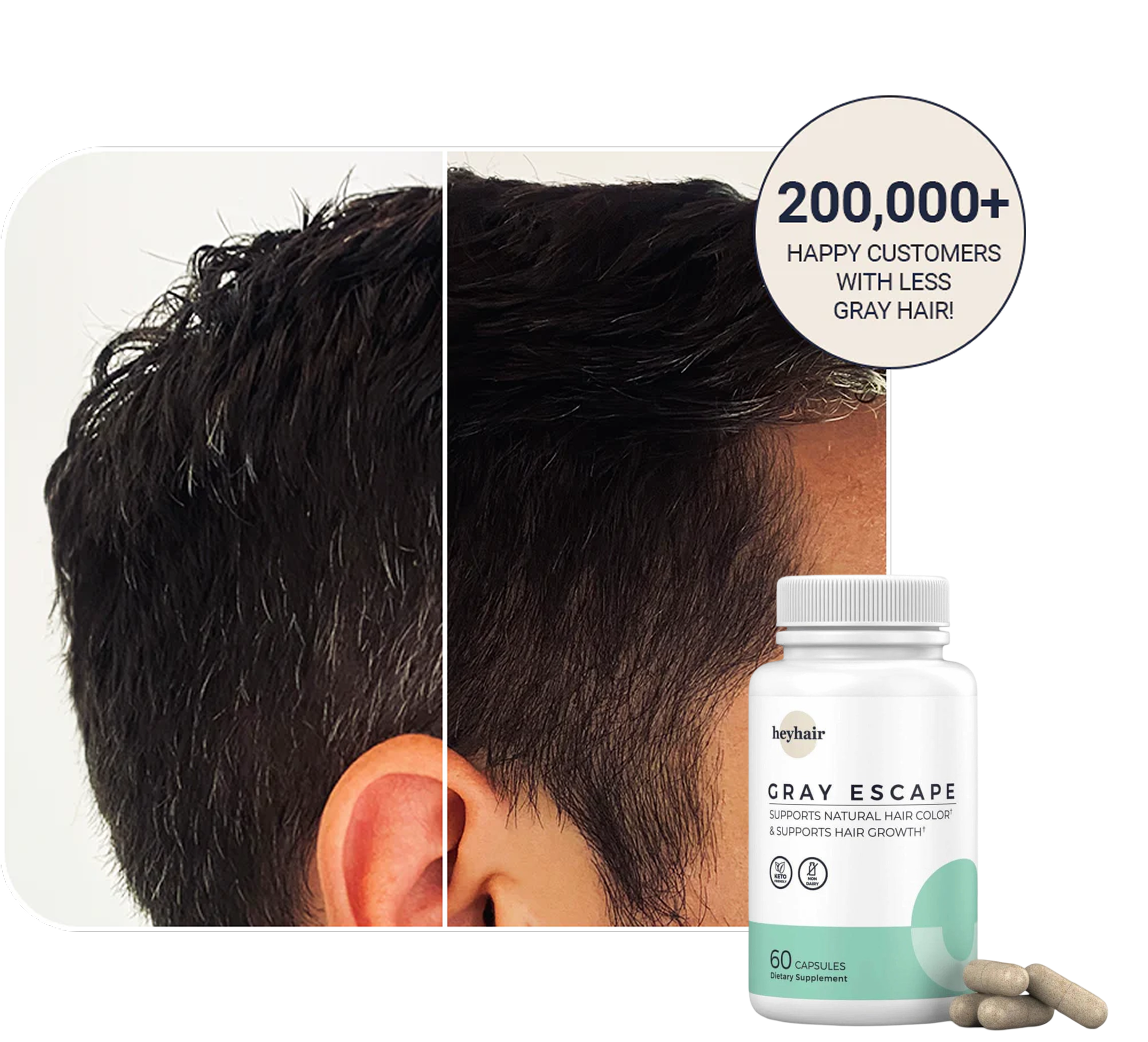 Before and after images of hair color change with a Gray Escape supplement bottle.