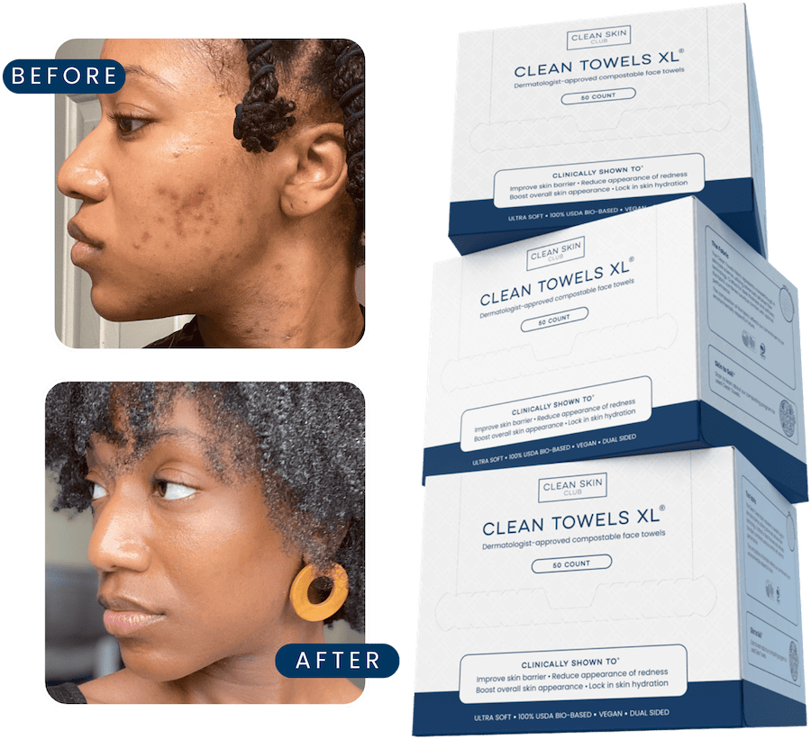 Before and after images of a woman's face with Clean Towels XL boxes.