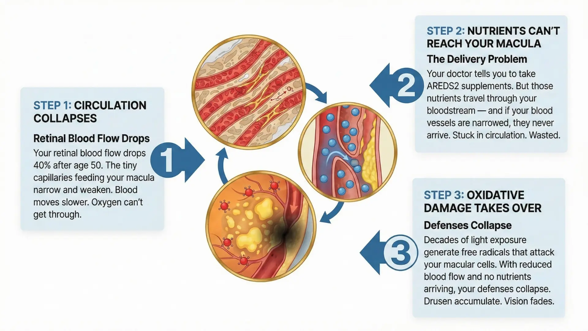 An infographic illustrating a three-step cycle of macular degeneration, from poor circulation to oxidative damage.