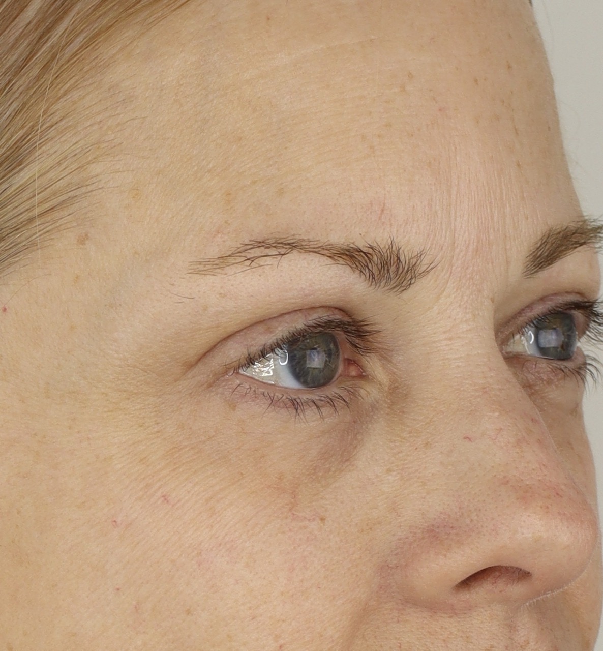A close-up of a woman's face, showing fine lines and wrinkles around her eyes and on her forehead.
