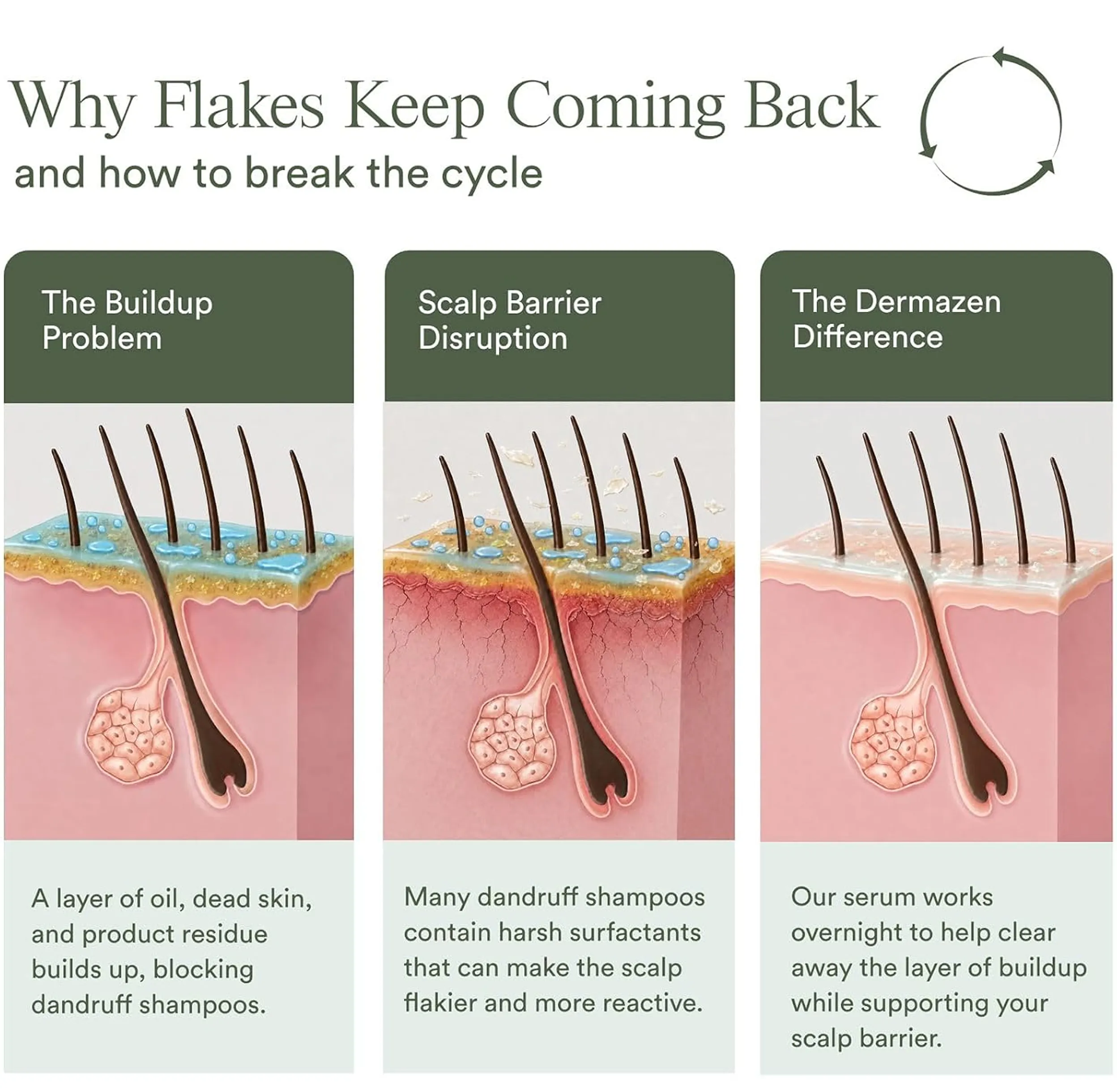 An infographic with three diagrams showing the causes of scalp flakes and the effect of a serum treatment.
