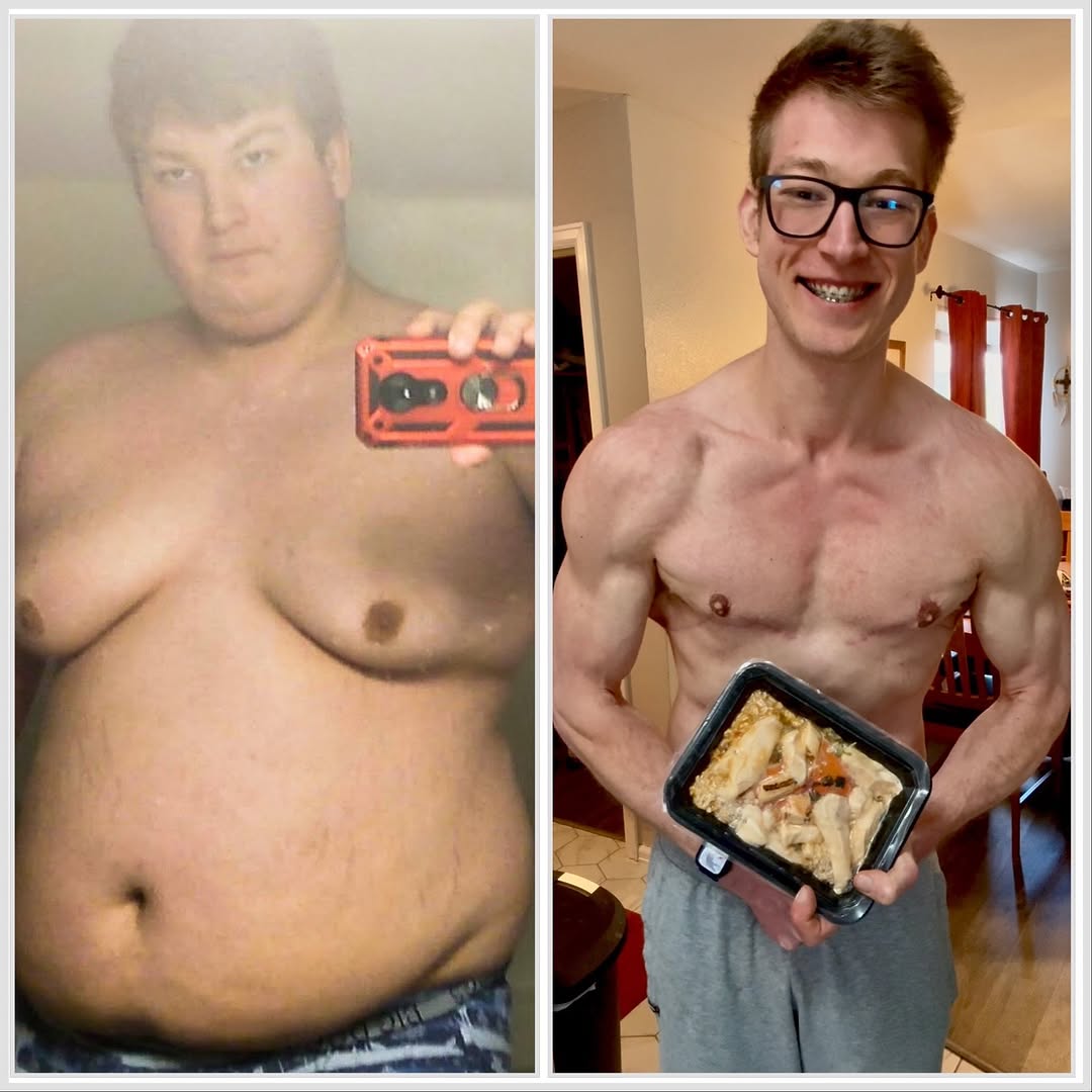 Side-by-side comparison of a person before and after weight loss.