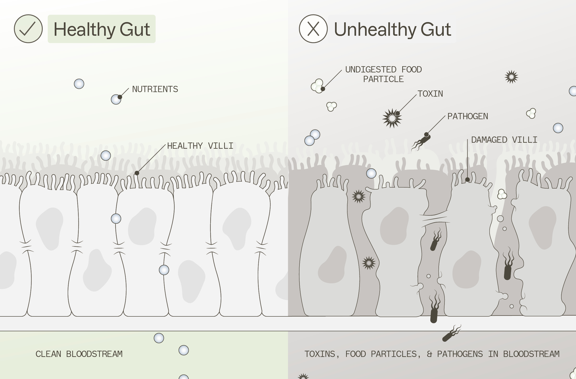 A diagram comparing a healthy gut with healthy villi to an unhealthy gut with damaged villi.