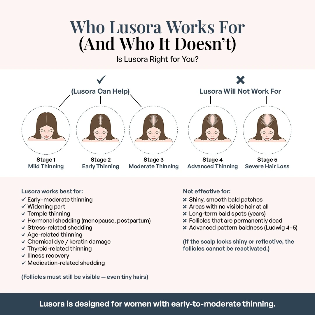 Diagram showing stages of hair thinning and who Lusora can and cannot help.
