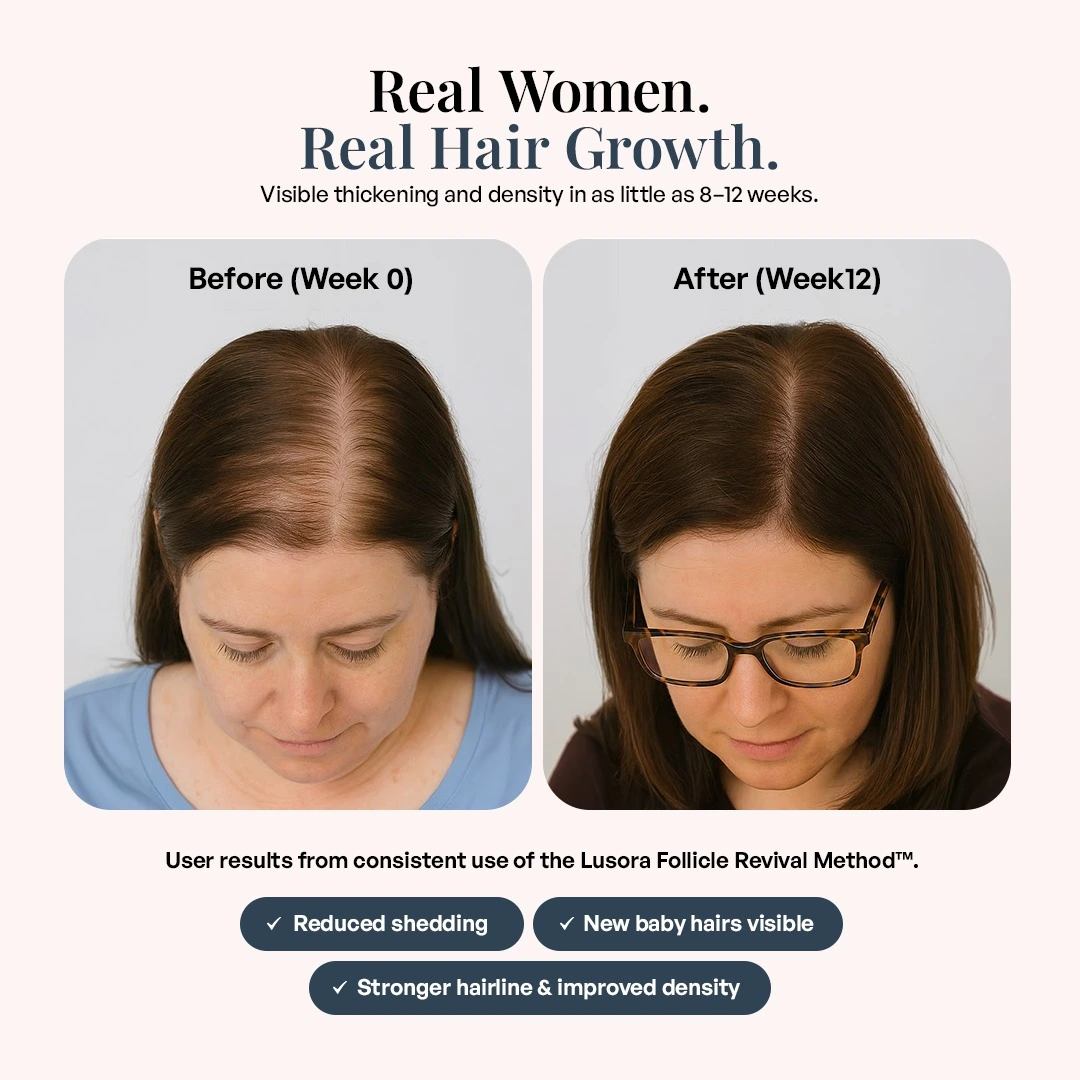 Before and after images of hair growth over 12 weeks.