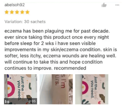 Screenshot of a product review for eczema treatment with images of sachets.