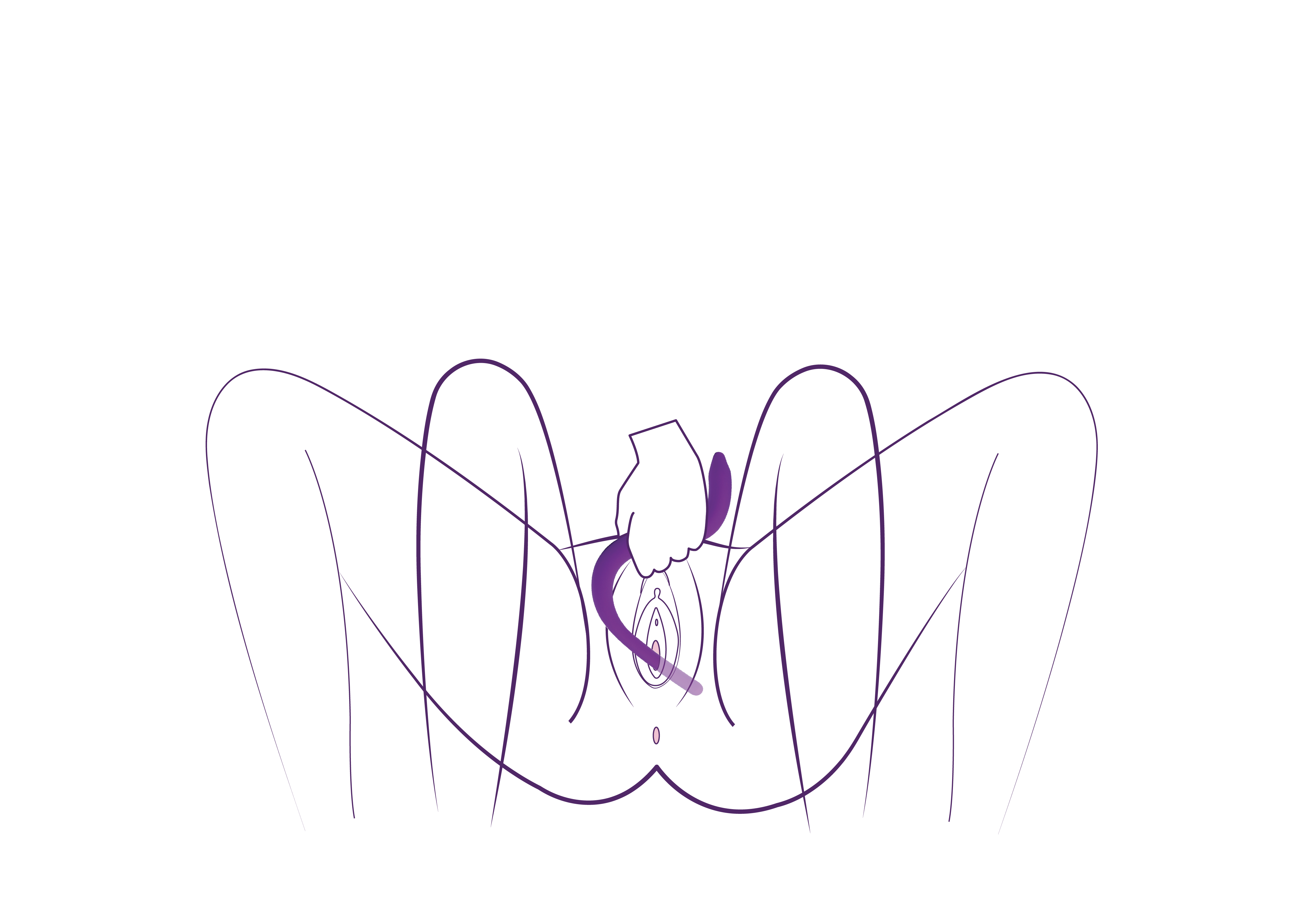 A purple line drawing illustrating the insertion of a curved device into a vagina.