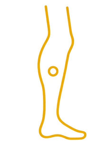 A yellow line drawing icon of a human leg with a circle on the shin.