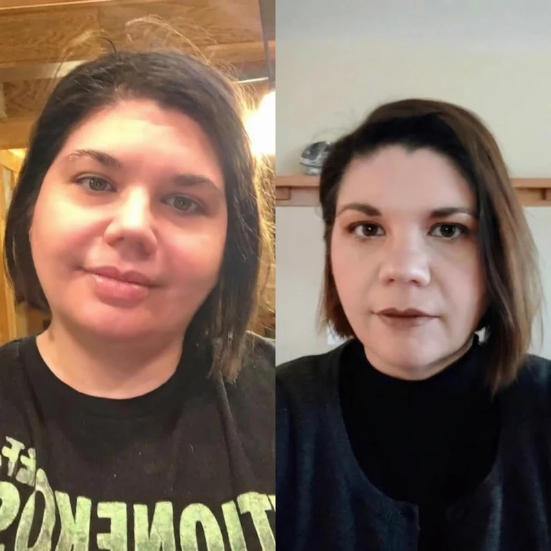 A side-by-side comparison photo showing a woman's facial transformation.