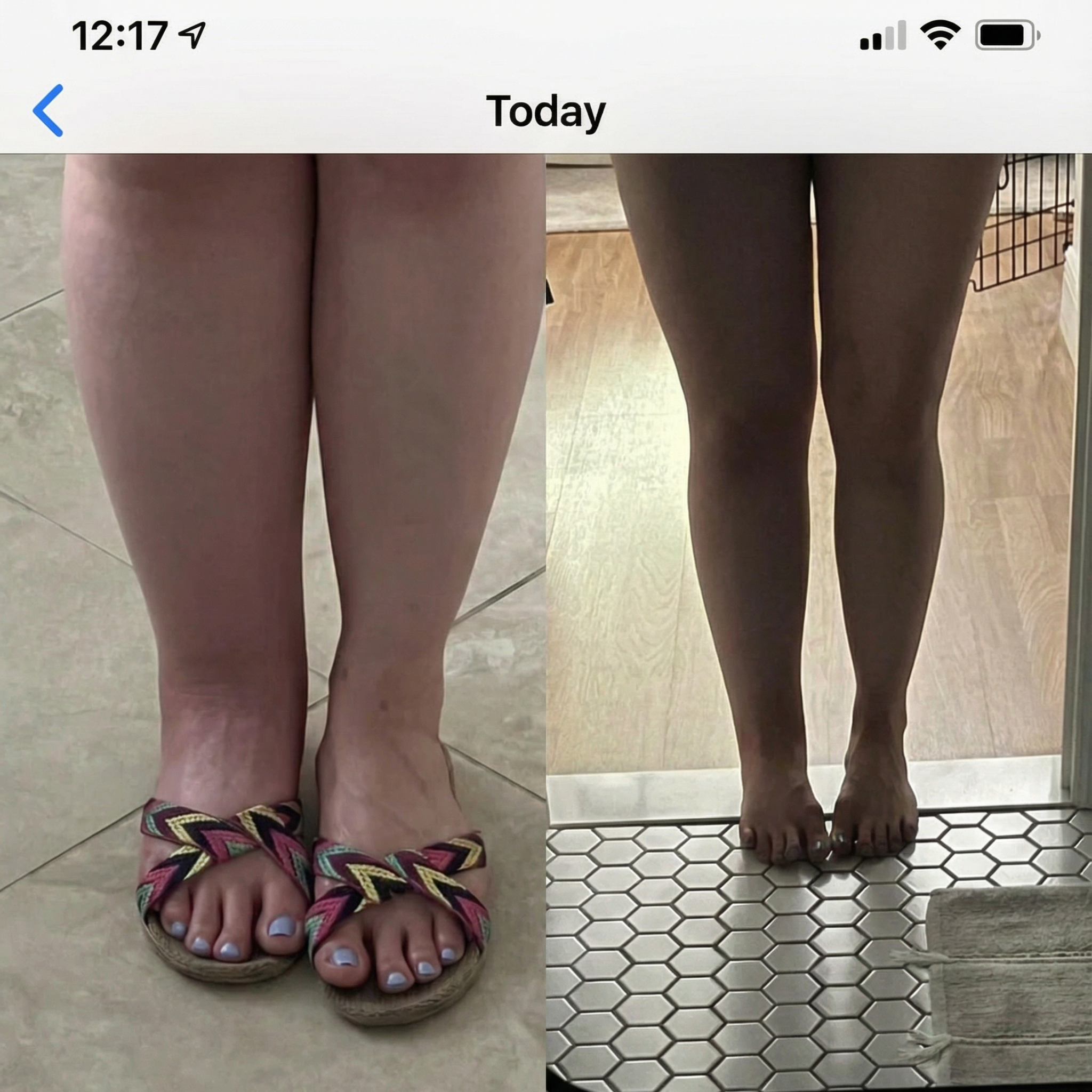 A before-and-after photo showing a comparison of a person's legs from the knees down.