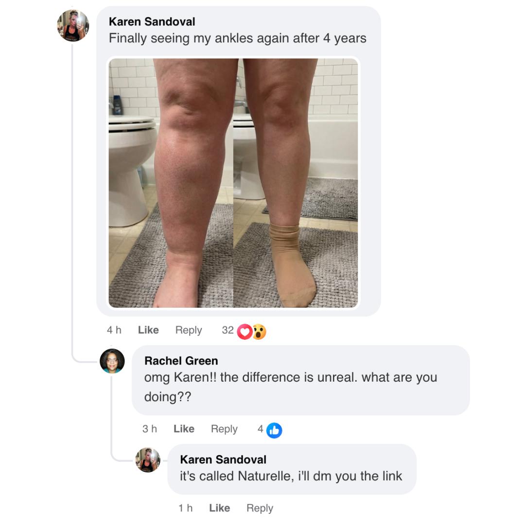 A screenshot of a social media conversation about a before-and-after photo of a woman's legs.