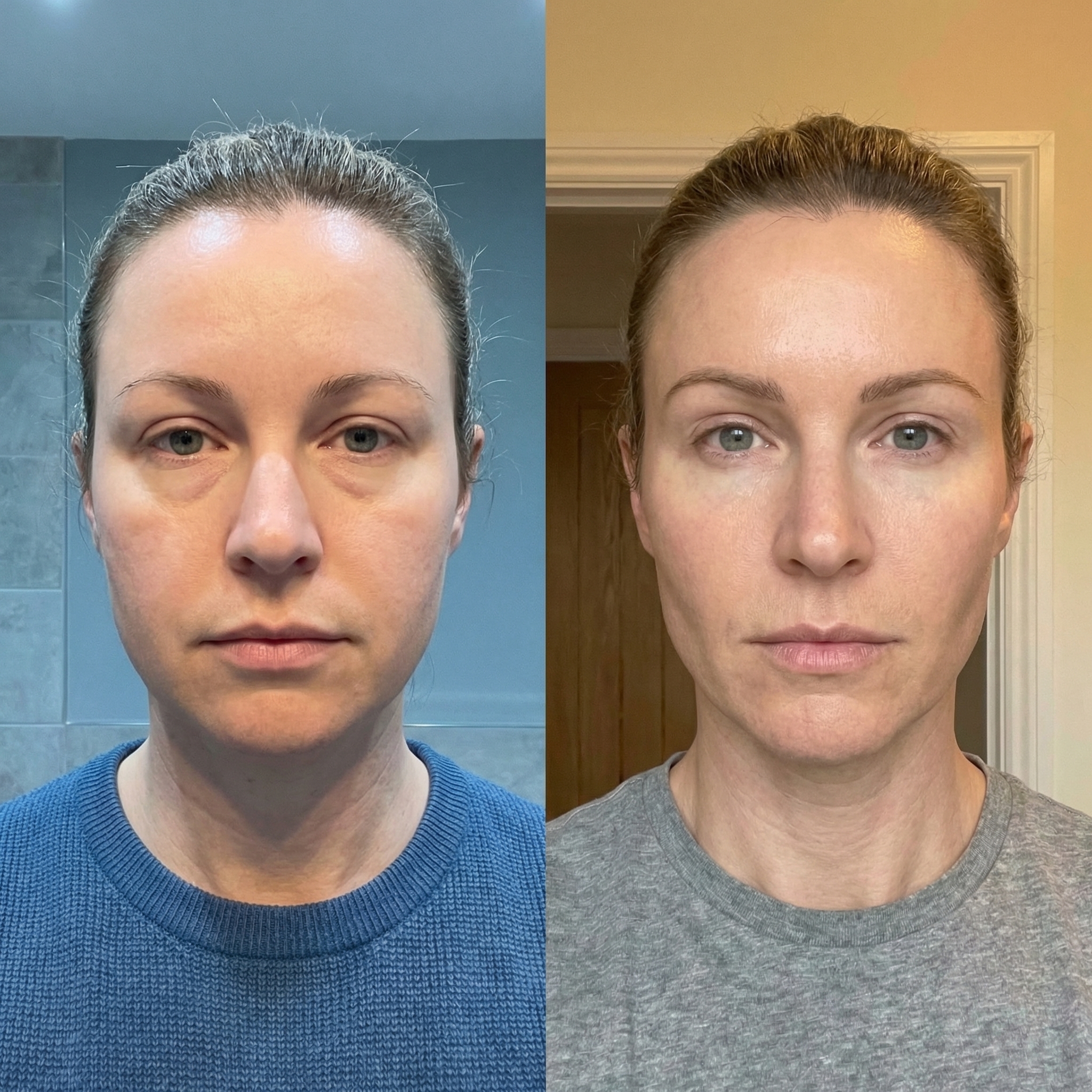 A side-by-side comparison photo of a woman's face, showing a visible improvement in skin texture and tone.