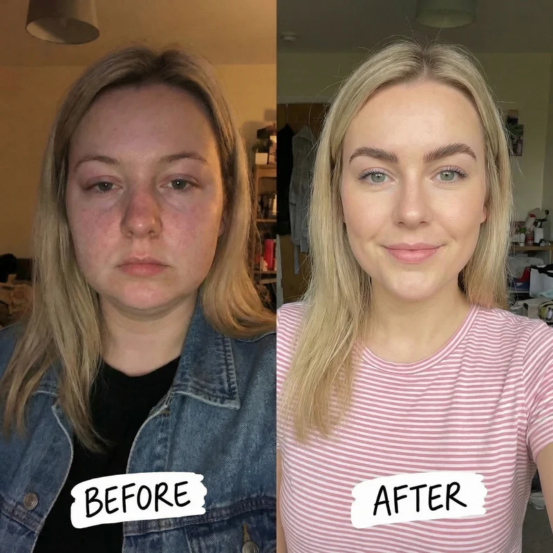 A side-by-side before and after image showing a transformation in a woman's facial appearance.