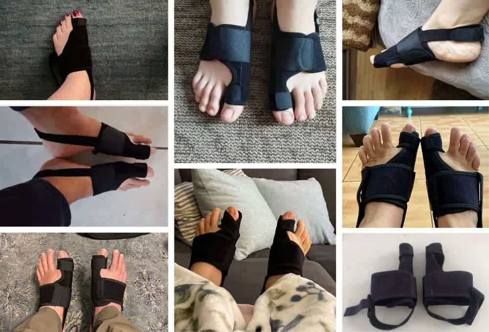 Collage of feet wearing black toe separators or bunion correctors.