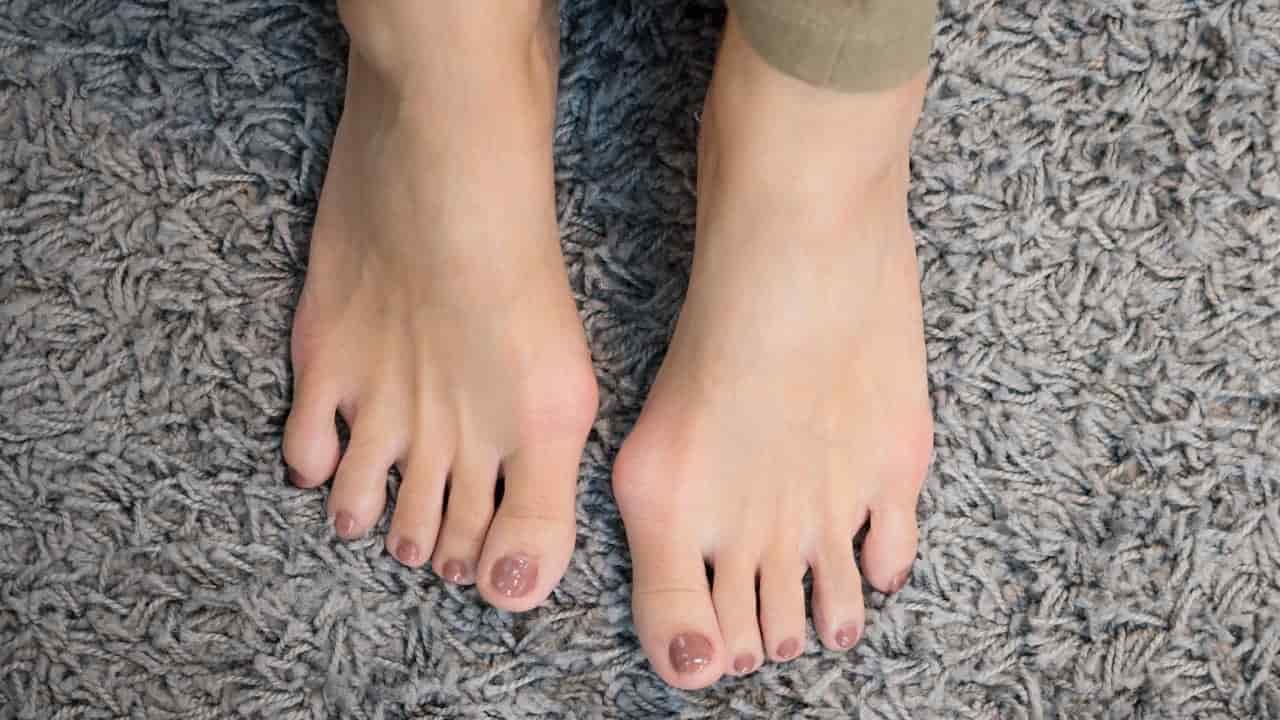 Two feet with painted toenails on a gray carpet.