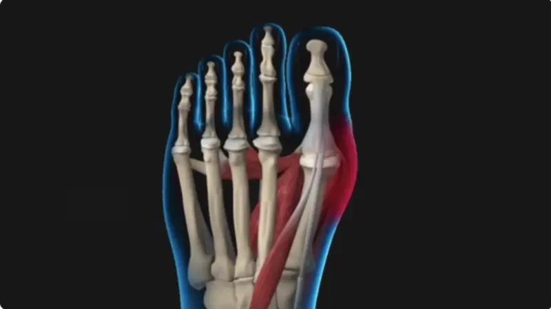 Anatomical illustration of a human foot showing bones and muscles.