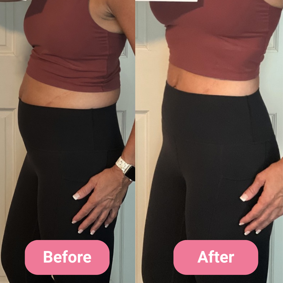 Side-by-side comparison of a woman's midsection labeled 'Before' and 'After.'